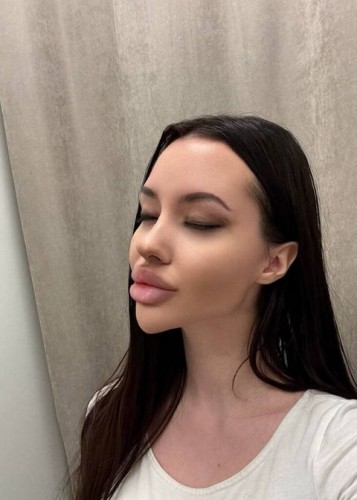 Лисса, Г. Джанкой